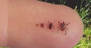 Doctor explains what you should know about ticks