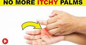 Why Do I Have Itchy Palms | Itchy Palms Treatment | Palm Itching Reasons