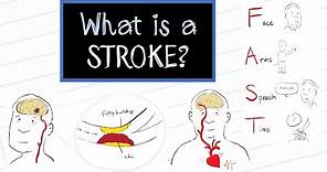 What is a Stroke? (HealthSketch)