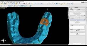 BSP 4.8 New Surgical Guide Path of Insertion Functionality