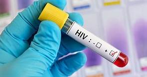 Cabotegravir, el nuevo tratamiento inyectable "altamente eficaz" en la prevención del VIH - La Opinión
