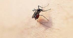 健康網》被蚊子咬狂抓 醫教有效止癢及除疤法 - 自由健康網