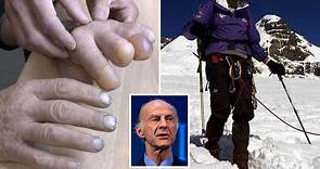 Sir Ranulph Fiennes sawed off his own fingers after becoming ‘irritable’ from frostbite pain