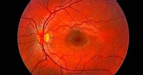 Mácula Ocular, ¿qué es y cuál es su función? - Dr. Gallego Pinazo