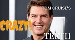 Tom Cruise's CRAZY teeth!!