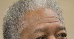 Morgan Freeman es operado tras el grave accidente de coche