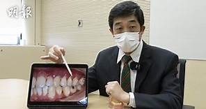 刷牙Q＆A｜刷牙流牙血怎辦？港大牙醫學院講座教授講解成因、處理方法【短片示範：刷牙正確方法、牙線牙縫刷操作】 (10:18) - 20221202 - 熱點