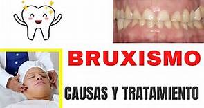 Bruxismo o rechinar de dientes: Causas, consecuencias, tratamiento y ejercicios