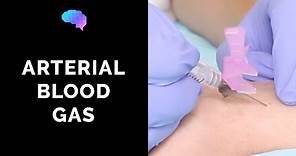 How to take an arterial blood gas (ABG) - OSCE guide | UKMLA | CPSA