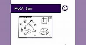 Montreal Cognitive Assessment (MoCA): Administration and Scoring