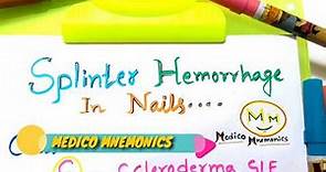 Mnemonic For Causes of Splinter fingernail,Splinter Hemorrhages, For NEET-PG,USMLE Step 1 Prep