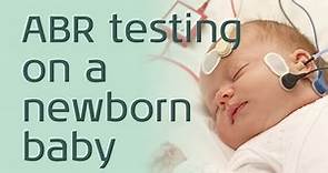 ABR: Testing a newborn baby