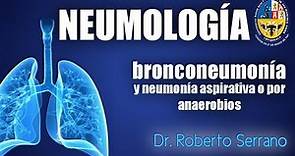 Bronconeumonía y neumonía aspirativa o por anaerobios - Neumología Dr. Serrano