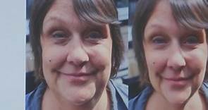 Kathy Burke: All Woman - Cosmetic Surgery