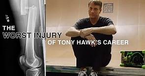 Tony Hawk Breaks Down The Worst Slam Of His Career