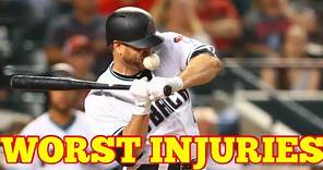 MLB | Worst Injuries Compilation in the MLB