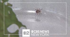 Connecticut man talks about his bout with rare Rocky Mountain spotted fever