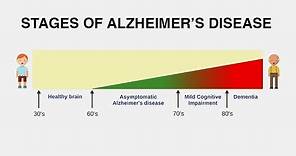 Diagnosing Alzheimer’s Disease