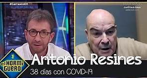 Antonio Resines habla sobre su larga lucha contra el Covid - El Hormiguero