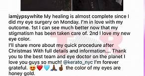 Model Jessica White DRAGGED For Getting Surgery To Change Eye Color Same As Tiny #LHHATL
