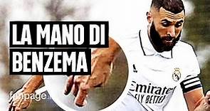Benzema mostra come è ora la sua mano: ha giocato senza benda per la prima volta in 4 anni