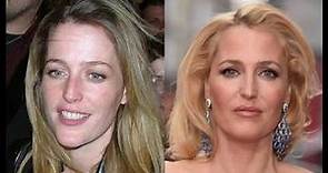 Gillian Anderson Plastic Surgery Before and After Photos