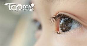 【護眼食物】抗氧化預防黃斑病變　15種護眼食物排名 - 香港經濟日報 - TOPick - 健康 - 保健美顏