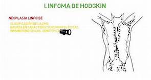 Linfoma de Hodgkin