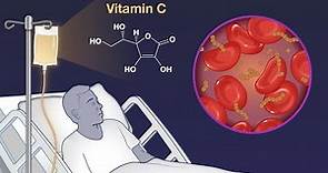 Intravenous Vitamin C for Sepsis in the ICU | NEJM