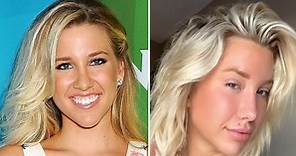 Savannah Chrisley Plastic Surgery: Transformation Photos