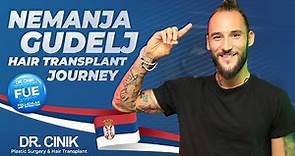 Nemanja Gudelj | FUE | Hair Transplant Journey | Dr. Cinik Hospital