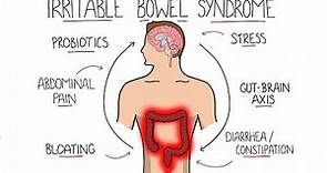 Irritable Bowel Syndrome (IBS) - Including Symptoms, Criteria & Treatment!