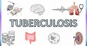 Tuberculosis - Types, Pathogenesis, Signs and Symptoms, Diagnosis, Treatment and Prevention