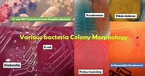 Various Bacteria Colonies Morphology Demo/ Proteus/Pseudomonas/Klebsiella/Pseudomonas/Streptococcus