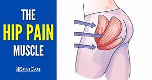 The Hip Pain Muscle (How to Release It for INSTANT RELIEF)