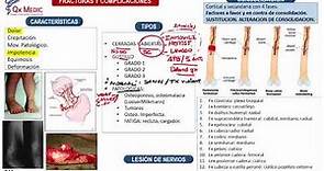 Fracturas: Generalidades - Ortopedia y Traumatología (Clases Qx Medic) - 01