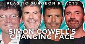 Simon Cowell Plastic Surgery: Addicted to Botox + Filler?