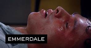 Emmerdale - Jacob Has A Severe Allergic Reaction