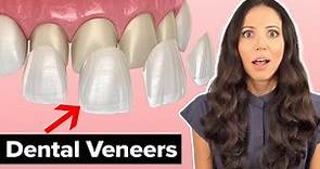 Dental Veneers Procedure Explained