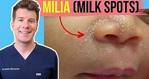 Doctor explains MILIA (aka MILK SPOTS) in babies and infants | Including symptoms and photos