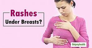 5 Effective Home Remedies For Rashes Under Breasts