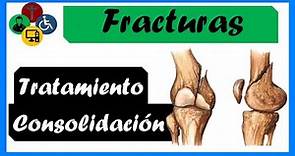 🦴 FRACTURAS - Tipos, CONSOLIDACIÓN y TRATAMIENTO #fractures