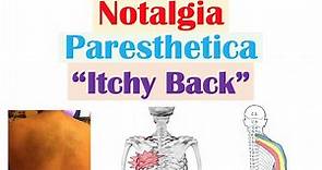Notalgia Paresthetica (“Itchy Back”) | Causes, Risk Factors, Symptoms, Diagnosis, Treatment