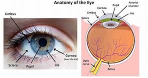 An Approach to a Red Eye