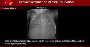 Respiratory Distress Syndrome in Neonates (Hyaline Membrane Disease)