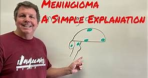 Meningioma A Simple Explanation