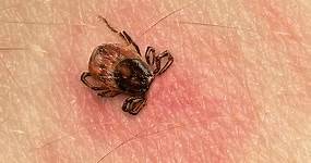 Here’s What a Tick Bite Actually Looks Like