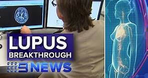 New drug breakthrough for lupus sufferers | Nine News Australia