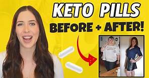 Keto Pills Before And After (REAL Keto Diet Pills Review!)