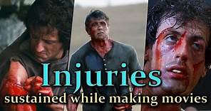 Sylvester Stallone - Injuries sustained while making movies